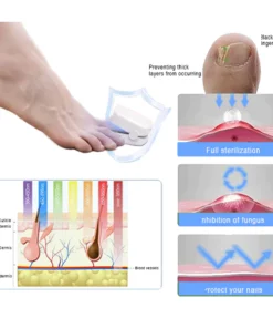 Oveallgo™ Revolutionary PharmaPro High-Efficiency Light Therapy Device For Toenail Diseases