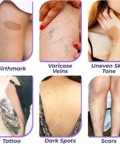 Alternative view of flysmus™ CoverPro Körper-Concealer