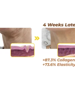 flysmus™ NaturalVital Bee Venom Essence