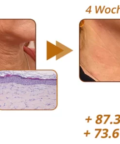 flysmus™ RevitaPeptide Umkehrserum