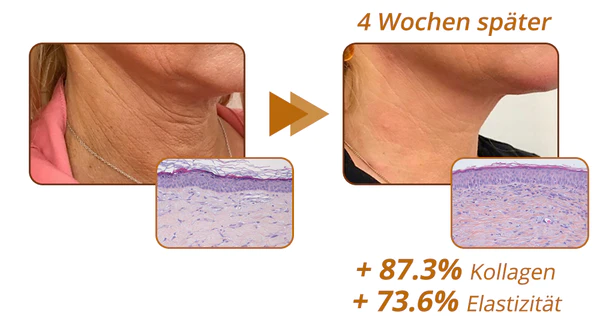 flysmus™ RevitaPeptide Umkehrserum