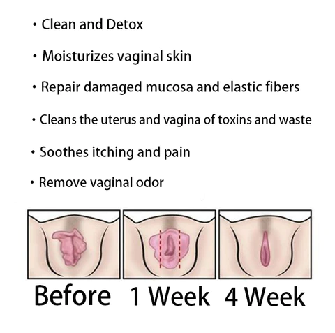 AAFQ® Onmiddellike Jeukverligting & Natuurlike Detox & Verstevigende Herstel & Pienk en Tender Natuurlike Kapsules