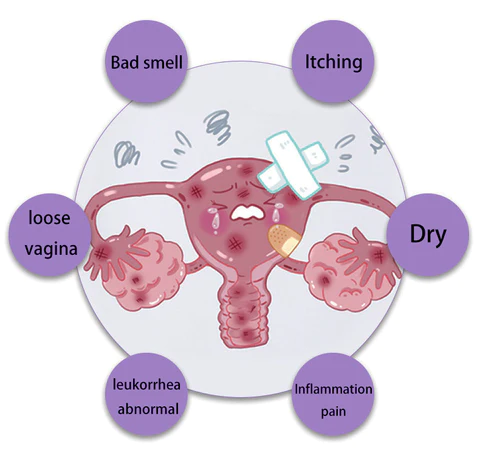 AAFQ™ Stoppino istantaneo per il prurito e disintossicante e riparatore dimagrante e rassodante e capsule naturali rosa e tenere PRO