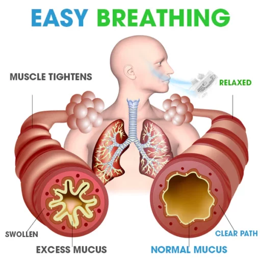 AEXZR™ Lung Care Filter Device