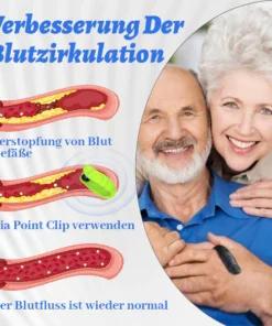 Ceoerty™ DiaPoint Clip