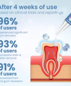 Ceoerty™ InstaSmile Gum Treatment Gel