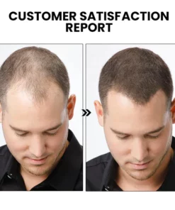 Dobshow™ Herbal Hair Strengthening Serum