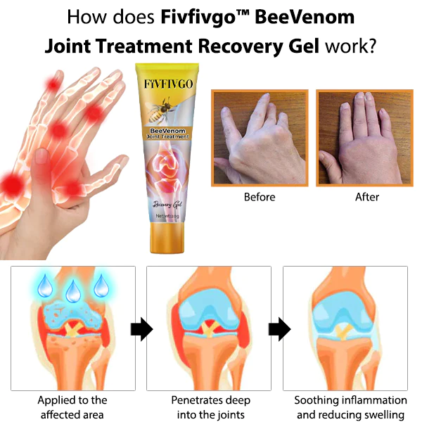 Fivfivgo™ BeeVenom Gelenkbehandlungs-Erholungsgel