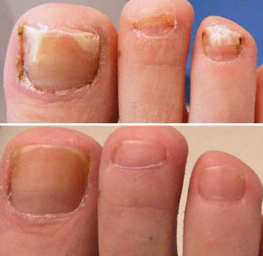 Fivfivgo™ PureGrowth Nagelpflege-Creme