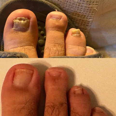 Fivfivgo™ PureGrowth Nagelpflege-Creme