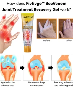 Fivfivgo™ BeeVenom Gelenkbehandlungs-Erholungsgel