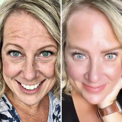 Fivfivgo™ LuxPro Bienengift-Serum