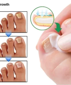 Fivfivgo™ PureGrowth Nagelpflege-Creme
