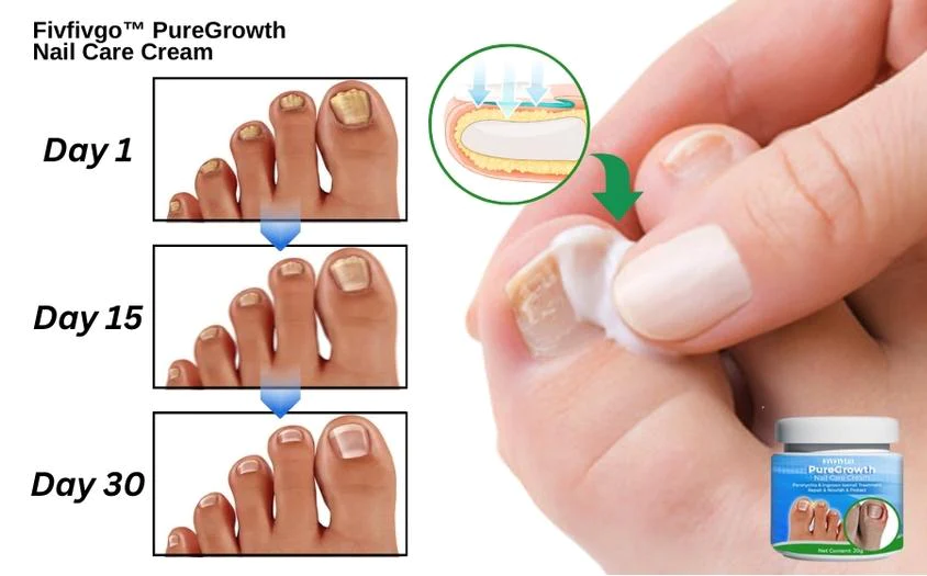 Fivfivgo™ PureGrowth Nagelpflege-Creme
