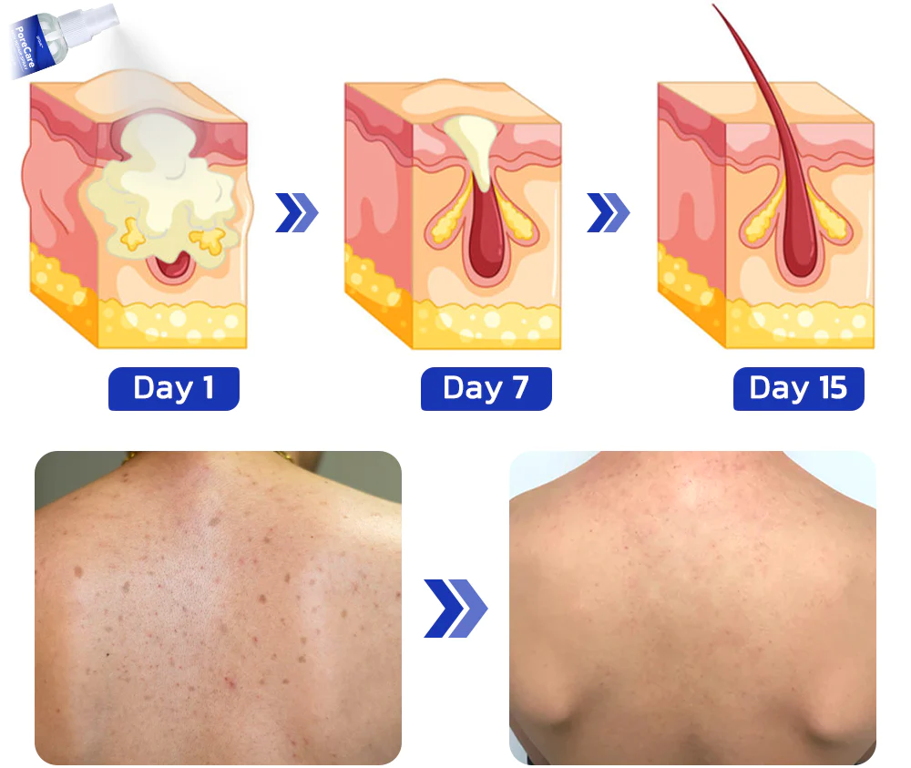 GFOUK™ PoreCare Skin Repair Spray
