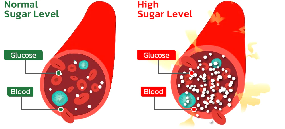 GFOUK™ SugarSuppl Health Control Spray