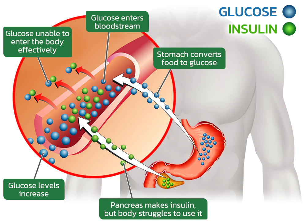 GFOUK™ SugarSuppl Health Control Spray