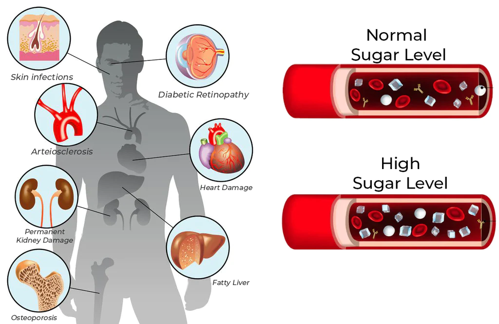 GFOUK™ SugarSync Gesundheit Kontrole Aerosolizer