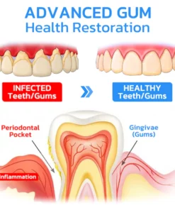 GFOUK™ Gum Instant Treatment Gel