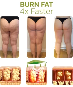 GFOUK™ HerbalLegs Cellulite Reduction Patches