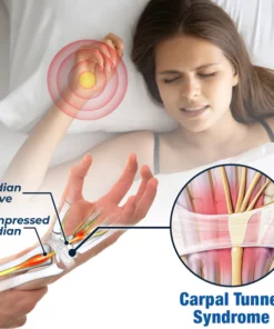 Alternative view of GFOUK™ NerveEase Karpaltunnel-Behandlungsgerät