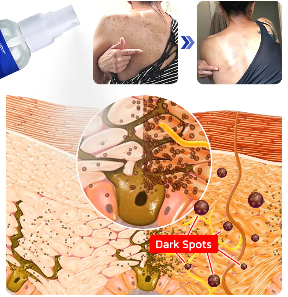 GFOUK™ PoreCare Skin Repair Spray