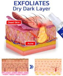 GFOUK™ PoreCare Skin Repair Spray