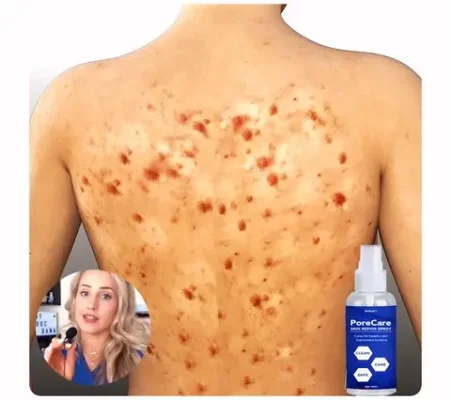 GFOUK™ PoreCare Skin Repair Spray