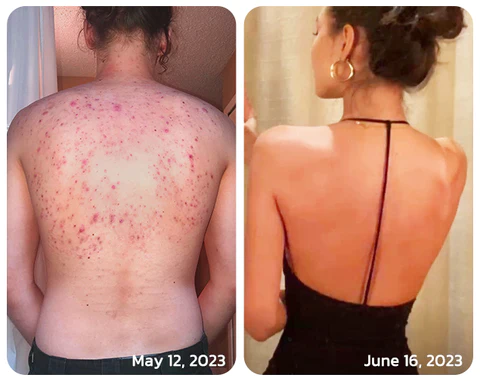 GFOUK™ PoreCare Skin Repair Spray