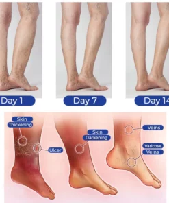 Alternative view of GFOUK™ VascuCare Vein Comfort Spray