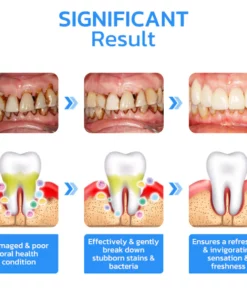 GFOUK™ Zahnfleisch-Sofort-Behandlungsgel