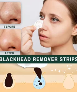 Kisshi™ Nose Plants Pore Strips