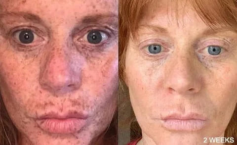 Kurkuma Anti-Oxidationserum