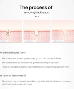 LANBENA Face Blackheads Remover Peel