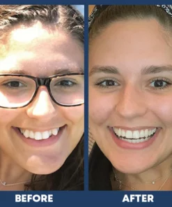 LIMETOW™ Dental Orthodontic Braces