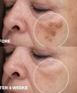 LIMETOW™ Snow Bleach Cream