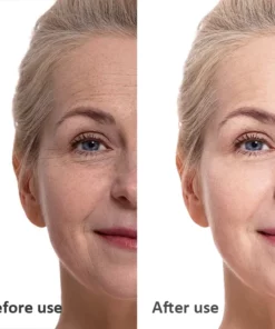 LIMETOW™ Soluble 24k Gold Protein Lifting Thread Set