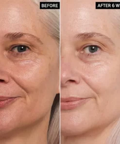 LIMETOW™ Soluble 24k Gold Protein Lifting Thread