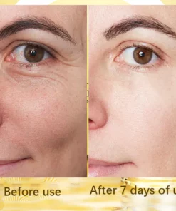 LIMETOW™ Soluble 24k Gold Protein Lifting Thread