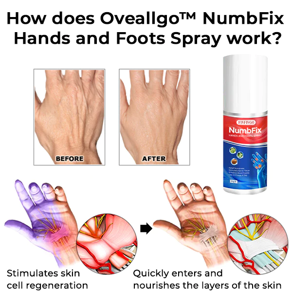 Oveallgo™ NumbFix Hands and Foots Spray