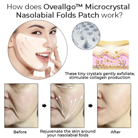 Oveallgo™ PROMAX Microcrystal Nasolabial Folds Patch