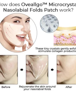 Oveallgo™ PROMAX Microcrystal Nasolabial Folds Patch