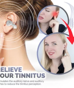 Oveallgo™ PureHear Ear Acupoint Device