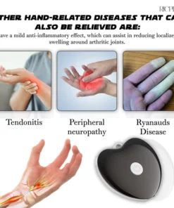 Alternative view of RICPIND NerveRelief Carpal Tunnel Therapy Device