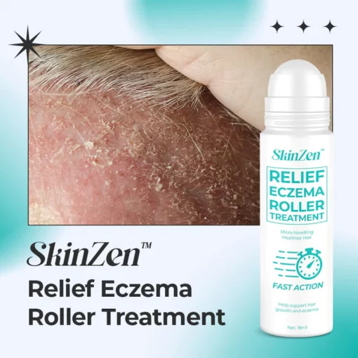SkinZen™ Relief Eczema Roller Treatment - Image 3