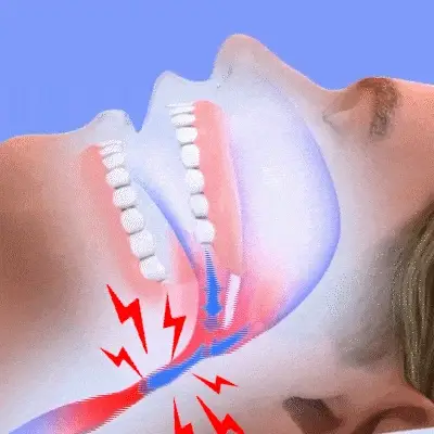 SleepZ™ Snore-free Mouth Piece