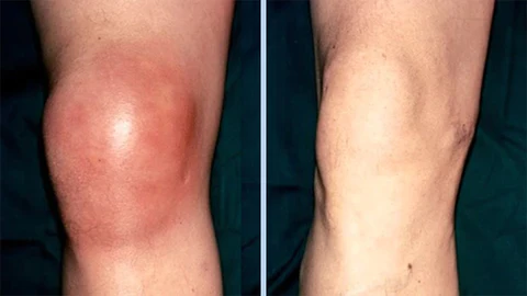 Wewersh® JointRevive Bone Healing Gel Roll-On