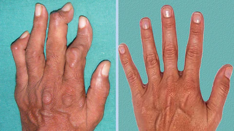 Wewersh® JointRevive Bone Healing Gel Roll-On