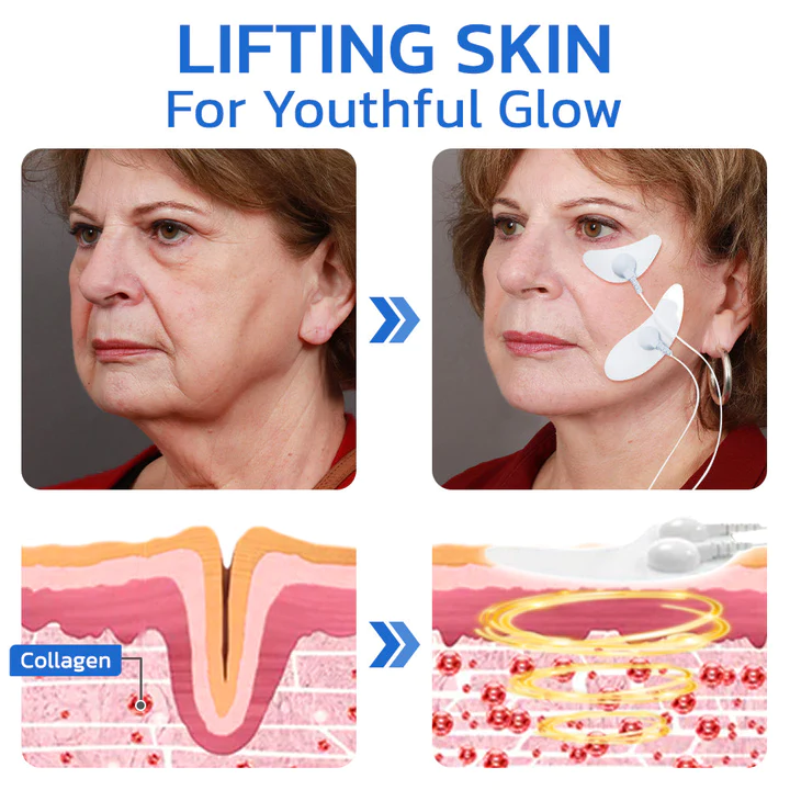 flysmus™ BeautyTENS VFace Facial Pules-toestel