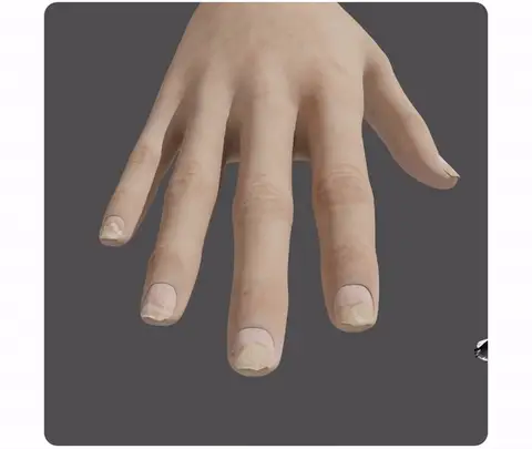 flysmus™ OnycholysisHeal Nail Strengthening And Growth Conditioner